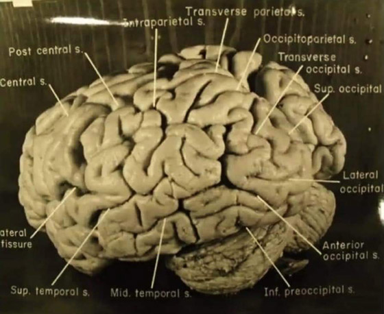 هل دماغه مختلف فعلا؟ قصة سرقة دماغ أينشتاين واللعنة التي أصابت سارقه صورة رقم 11
