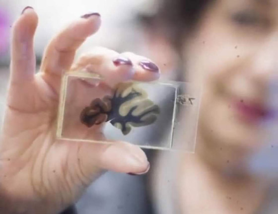 هل دماغه مختلف فعلا؟ قصة سرقة دماغ أينشتاين واللعنة التي أصابت سارقه صورة رقم 4