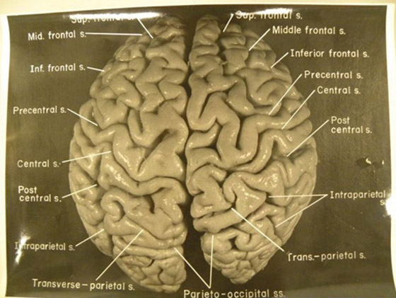 هل دماغه مختلف فعلا؟ قصة سرقة دماغ أينشتاين واللعنة التي أصابت سارقه صورة رقم 12