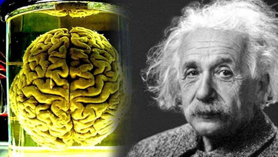 هل دماغه مختلف فعلا؟ قصة سرقة دماغ أينشتاين واللعنة التي أصابت سارقه صورة رقم 13