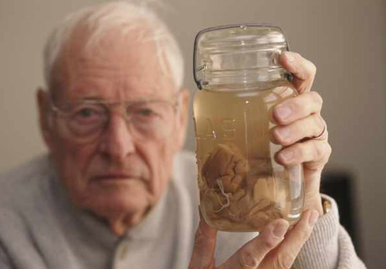 هل دماغه مختلف فعلا؟ قصة سرقة دماغ أينشتاين واللعنة التي أصابت سارقه صورة رقم 5