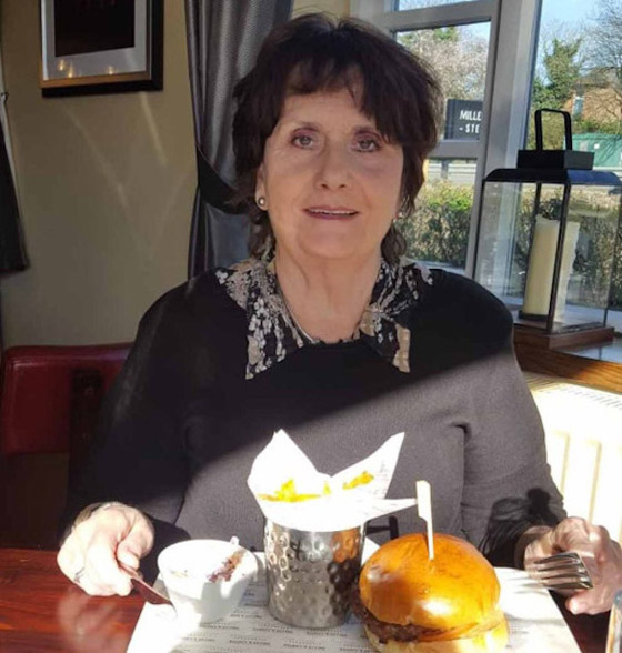 زوجان يرى كل منها الآخر لأول مرة منذ سنوات بفضل عملية جراحية صورة رقم 4