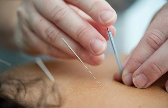 علاجات شائعة للوجه يمكن أن تضر البشرة صورة رقم 2