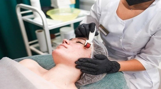 علاجات شائعة للوجه يمكن أن تضر البشرة صورة رقم 1