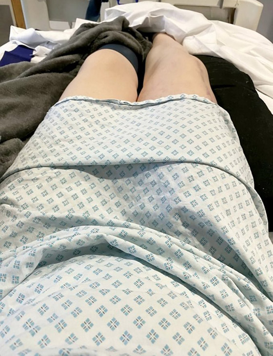قصة أم بريطانية مصابة بالسرطان اختارت بتر ساقها على إجهاض جنينها! صورة رقم 8 قصة أم بريطانية مصابة بالسرطان اختارت بتر ساقها على إجهاض جنينها! صورة رقم 8