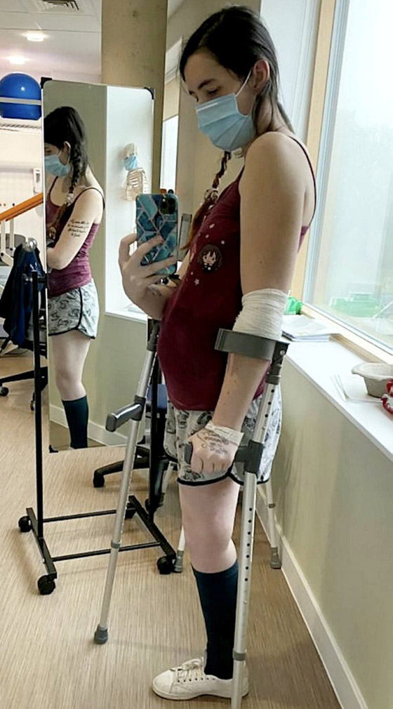 قصة أم بريطانية مصابة بالسرطان اختارت بتر ساقها على إجهاض جنينها! صورة رقم 9 قصة أم بريطانية مصابة بالسرطان اختارت بتر ساقها على إجهاض جنينها! صورة رقم 9
