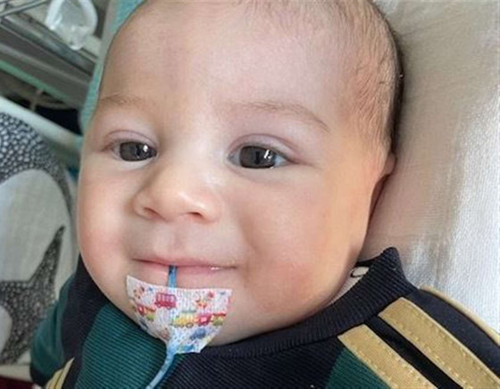 طفل لم يبكِ منذ وُلد! مرض نادر بدون اسم يحرم مولودا من حالته الطبيعية صورة رقم 9