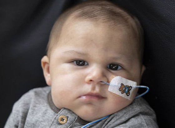 طفل لم يبكِ منذ وُلد! مرض نادر بدون اسم يحرم مولودا من حالته الطبيعية صورة رقم 10