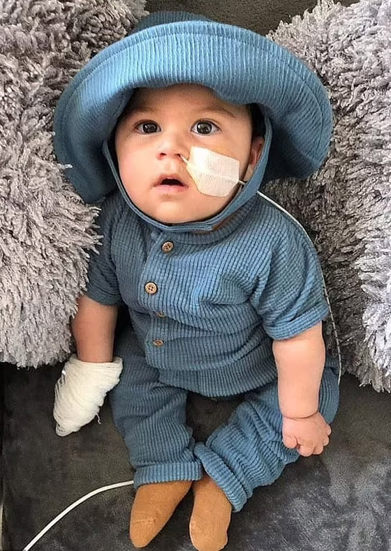 طفل لم يبكِ منذ وُلد! مرض نادر بدون اسم يحرم مولودا من حالته الطبيعية صورة رقم 4