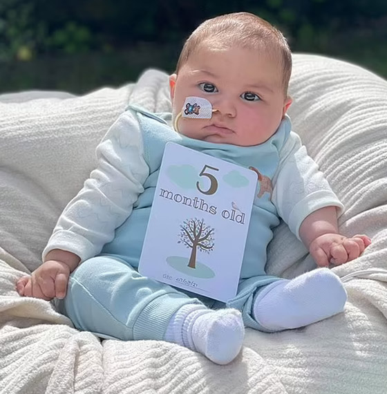 طفل لم يبكِ منذ وُلد! مرض نادر بدون اسم يحرم مولودا من حالته الطبيعية صورة رقم 5