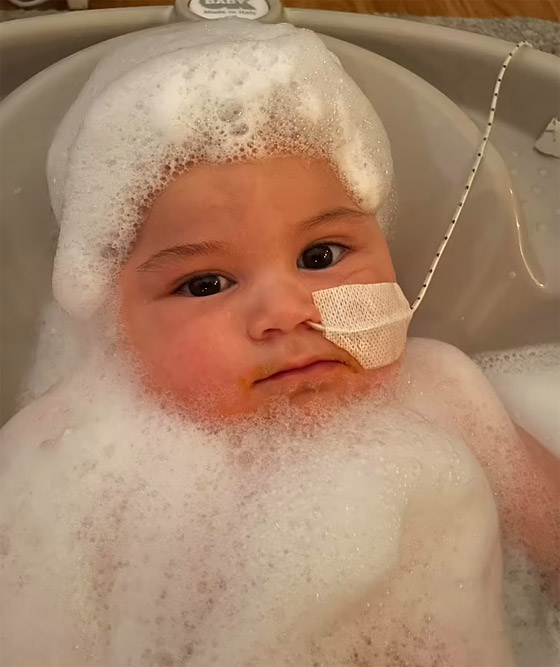 طفل لم يبكِ منذ وُلد! مرض نادر بدون اسم يحرم مولودا من حالته الطبيعية صورة رقم 6