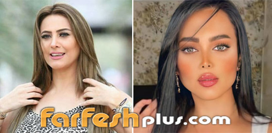 صور نجمات قبل وبعد عمليات التجميل والتغيير صادم: سوسن هارون، دنيا بطمة و صورة رقم 1 صور نجمات قبل وبعد عمليات التجميل والتغيير صادم: سوسن هارون، دنيا بطمة و صورة رقم 1