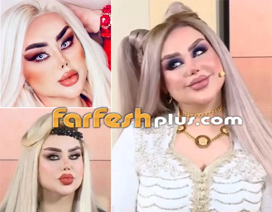 صور نجمات قبل وبعد عمليات التجميل والتغيير صادم: سوسن هارون، دنيا بطمة و صورة رقم 6 صور نجمات قبل وبعد عمليات التجميل والتغيير صادم: سوسن هارون، دنيا بطمة و صورة رقم 6