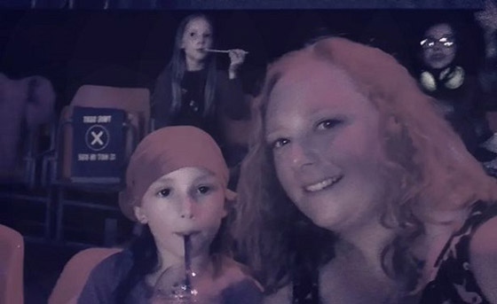 التوتر يصيب فتاة بالصلع صورة رقم 3