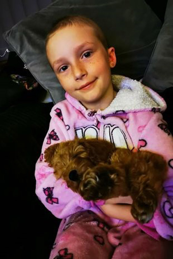 التوتر يصيب فتاة بالصلع صورة رقم 2