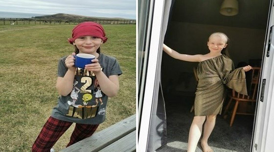 التوتر يصيب فتاة بالصلع صورة رقم 1