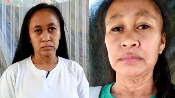 حالة نادرة.. فتاة فلبينية بعمر 16 عاما بوجه امرأة في سن الـ50! صورة رقم 2 حالة نادرة.. فتاة فلبينية بعمر 16 عاما بوجه امرأة في سن الـ50! صورة رقم 2