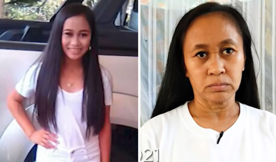 حالة نادرة.. فتاة فلبينية بعمر 16 عاما بوجه امرأة في سن الـ50! صورة رقم 5 حالة نادرة.. فتاة فلبينية بعمر 16 عاما بوجه امرأة في سن الـ50! صورة رقم 5