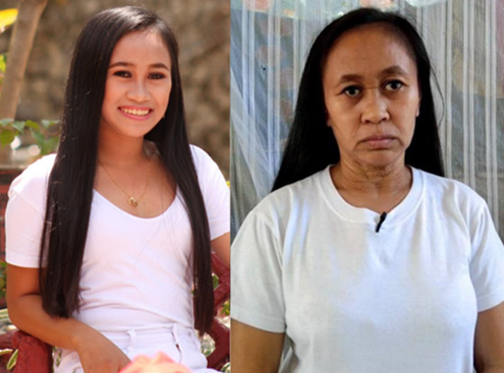 حالة نادرة.. فتاة فلبينية بعمر 16 عاما بوجه امرأة في سن الـ50! صورة رقم 7 حالة نادرة.. فتاة فلبينية بعمر 16 عاما بوجه امرأة في سن الـ50! صورة رقم 7