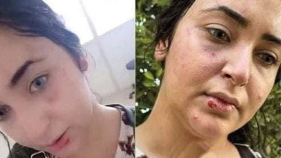 فيديو أثار الغضب الشديد: ضرب وسحل دكتورة صيدلانية مصرية لعدم لبسها الحجاب! صورة رقم 3 فيديو أثار الغضب الشديد: ضرب وسحل دكتورة صيدلانية مصرية لعدم لبسها الحجاب! صورة رقم 3