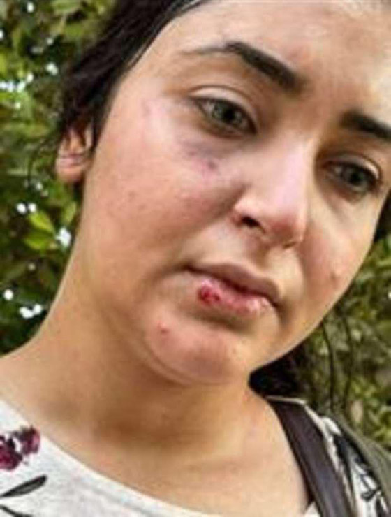 فيديو أثار الغضب الشديد: ضرب وسحل دكتورة صيدلانية مصرية لعدم لبسها الحجاب! صورة رقم 5 فيديو أثار الغضب الشديد: ضرب وسحل دكتورة صيدلانية مصرية لعدم لبسها الحجاب! صورة رقم 5