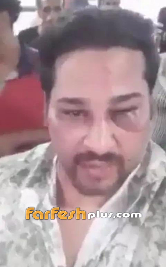 المغني الشعبي حمو بيكا إلى السجن.. إليكم صورة صادمة لضحيته! صورة رقم 1 المغني الشعبي حمو بيكا إلى السجن.. إليكم صورة صادمة لضحيته! صورة رقم 1