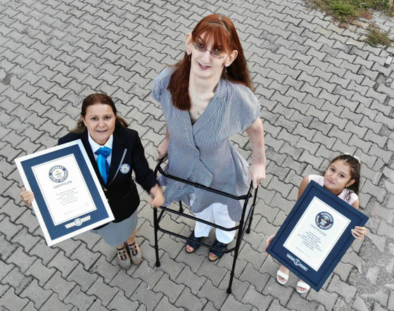 تركية تدخل موسوعة غينيس كأطول امرأة في العالم، ورسالتها: تقبلوا أنفسكم! صورة رقم 1