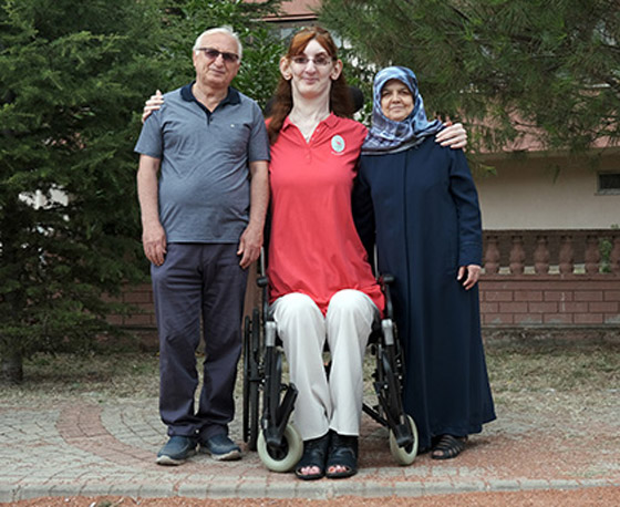 تركية تدخل موسوعة غينيس كأطول امرأة في العالم، ورسالتها: تقبلوا أنفسكم! صورة رقم 3