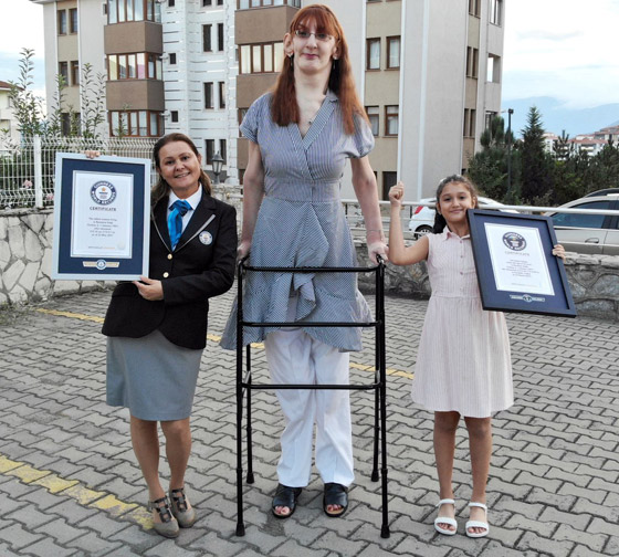 تركية تدخل موسوعة غينيس كأطول امرأة في العالم، ورسالتها: تقبلوا أنفسكم! صورة رقم 5