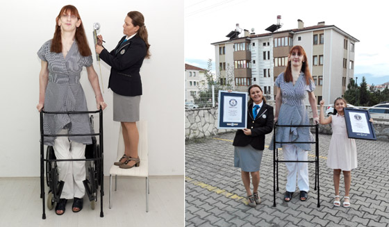 تركية تدخل موسوعة غينيس كأطول امرأة في العالم، ورسالتها: تقبلوا أنفسكم! صورة رقم 6