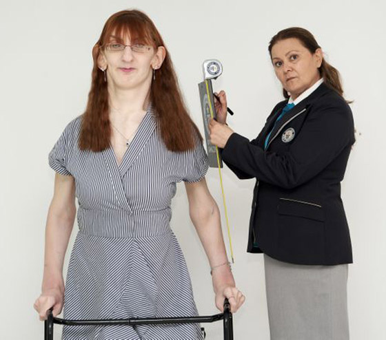 تركية تدخل موسوعة غينيس كأطول امرأة في العالم، ورسالتها: تقبلوا أنفسكم! صورة رقم 9