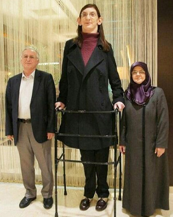 تركية تدخل موسوعة غينيس كأطول امرأة في العالم، ورسالتها: تقبلوا أنفسكم! صورة رقم 13