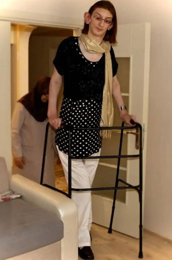 تركية تدخل موسوعة غينيس كأطول امرأة في العالم، ورسالتها: تقبلوا أنفسكم! صورة رقم 14