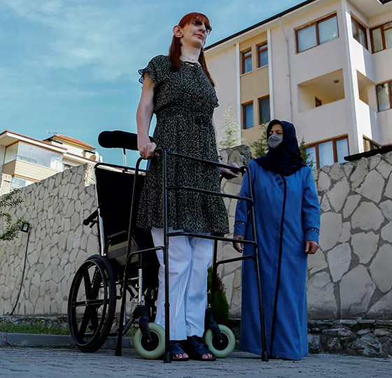 بالصور: تعرفوا إلى أطول النساء في العالم صورة رقم 2