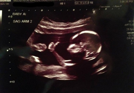 لقطات طريفة سترسم الابتسامة على وجهك: عليك بمشاهدتها صورة رقم 1