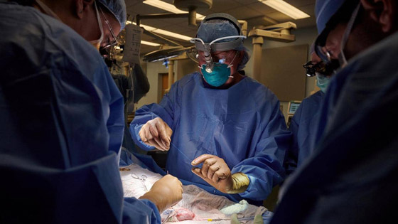 جراحون ينجحون في اختبار زرع كلية خنزير في مريضة من البشر صورة رقم 3