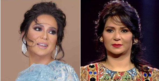 نجمات الخليج قبل وبعد التجميل  صور صادمه : صورة رقم 18
