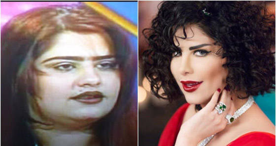 نجمات الخليج قبل وبعد التجميل  صور صادمه : صورة رقم 29