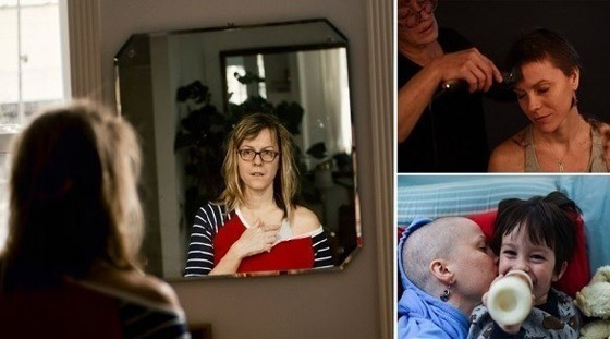 توثق رحلتها مع سرطان الثدي بصور واقعية يومية صورة رقم 1