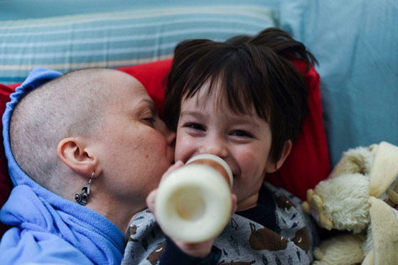 توثق رحلتها مع سرطان الثدي بصور واقعية يومية صورة رقم 5