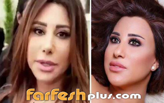 صور قبل وبعد: 15 فنانة اعترفن بإجراء عمليات تجميل غيرت شكلهن كليا صورة رقم 3