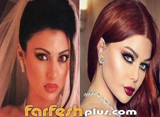 صور قبل وبعد: 15 فنانة اعترفن بإجراء عمليات تجميل غيرت شكلهن كليا صورة رقم 6