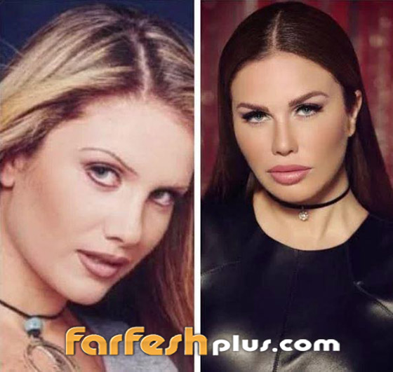 صور قبل وبعد: 15 فنانة اعترفن بإجراء عمليات تجميل غيرت شكلهن كليا صورة رقم 9