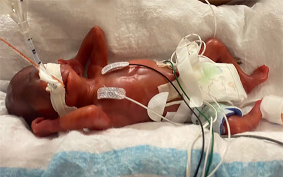 طفل أمريكي يحصل على لقب 