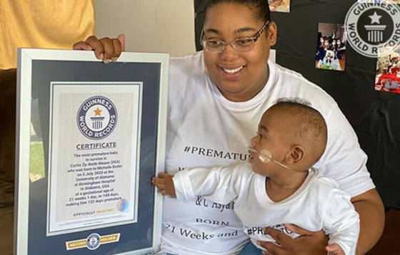 طفل أمريكي يحصل على لقب 