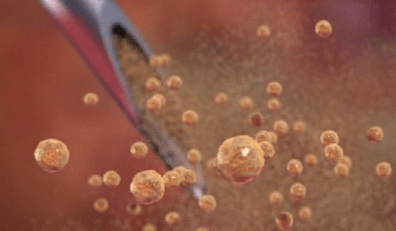 فيديو رائع لحظة بلحظة.. هكذا يخترق كورونا أجسادنا، وهكذا يعمل اللقاح! صورة رقم 3 فيديو رائع لحظة بلحظة.. هكذا يخترق كورونا أجسادنا، وهكذا يعمل اللقاح! صورة رقم 3