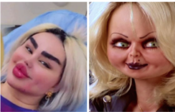 صور صادمة: داليا نعيم بعد عملية تجميلية، شفاهها مخيفة والجمهور: فيلم الرعب!! صورة رقم 3
