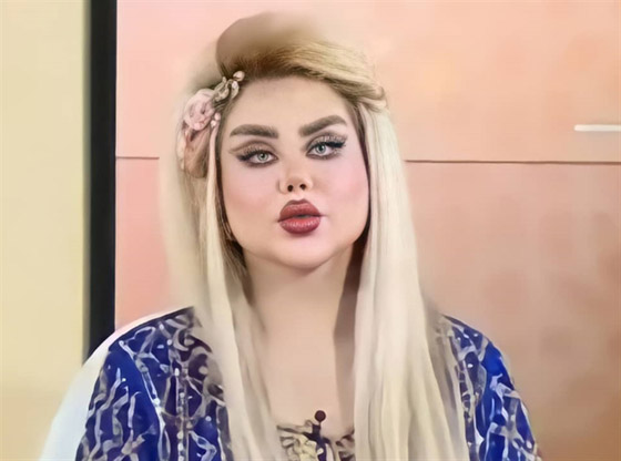 صور صادمة: داليا نعيم بعد عملية تجميلية، شفاهها مخيفة والجمهور: فيلم الرعب!! صورة رقم 5