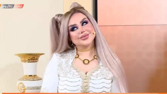 صور صادمة: داليا نعيم بعد عملية تجميلية، شفاهها مخيفة والجمهور: فيلم الرعب!! صورة رقم 6