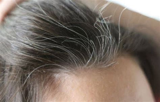 هكذا تتعاملين مع الشعر الأبيض صورة رقم 5